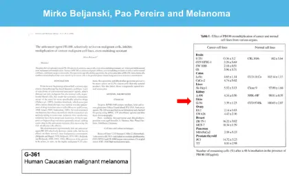 melanoma