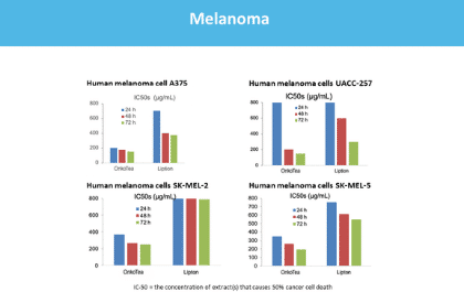 melanoma